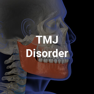 TMJ Disorder